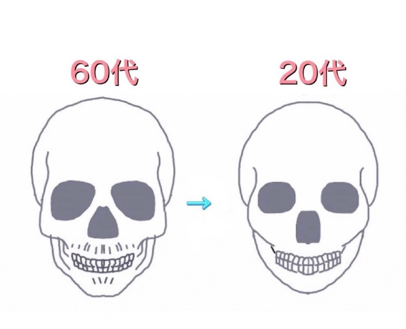 頭蓋骨の老化